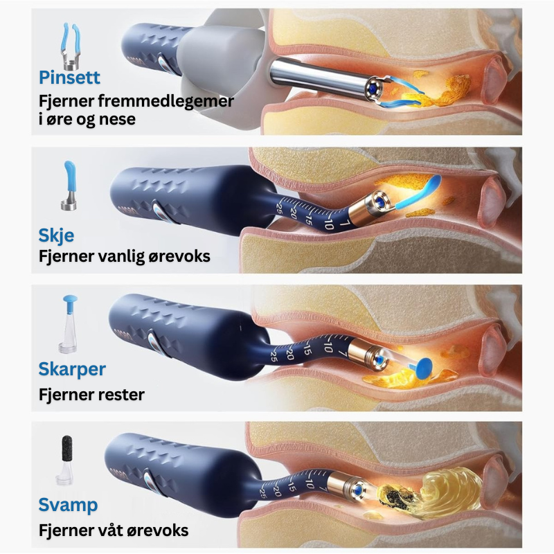 Bebird Multicare - Diagnostisk endoskop